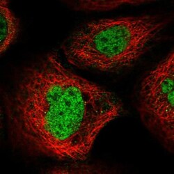 FBXO33 Antibody, Novus Biologicals 0.1mL; Unlabeled:Antibodies, Polyclonal